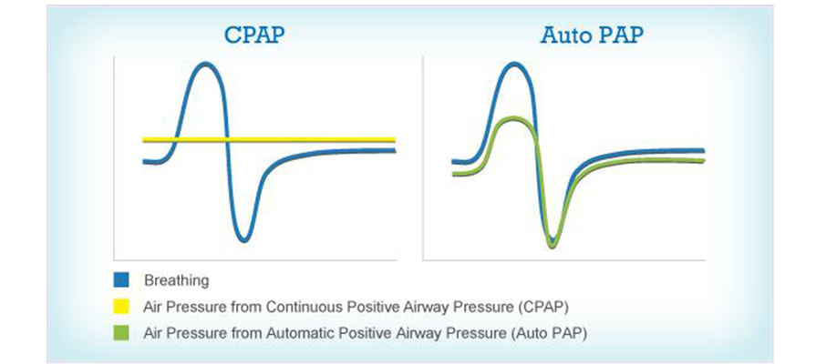 Fixed Pressure CPAP Machine and Automatic CPAP Machine Compared
